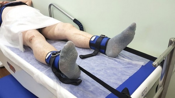 Обзор артроза коленного сустава 2 степени: особенности, симптомы и лечение