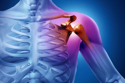 Растяжение связок плечевого сустава: причины и лечение
