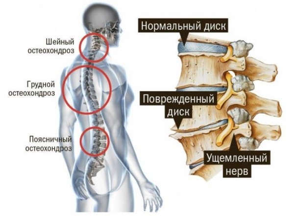 Гимнастика для шейно-грудного отдела позвоночника при болях