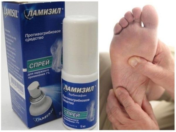 Применение Ламизила для лечения грибка ногтей – инструкция по применению и аналоги препарата