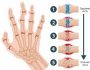 Боль в суставах рук и ног: причины и лечение, диагностика проблемы