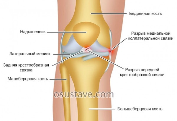 Самые частые причины ноющей боли в коленях, что делать, лечение