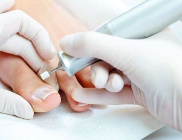 Особенности медицинского педикюра при грибке ногтей