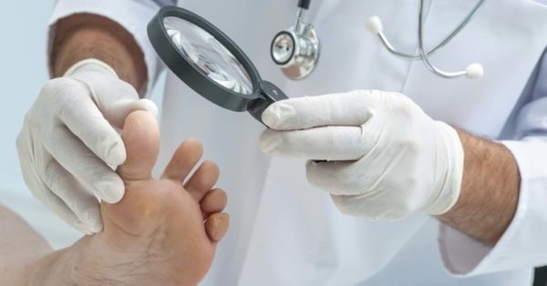 Лечение грибка ногтей на ногах в домашних условиях
