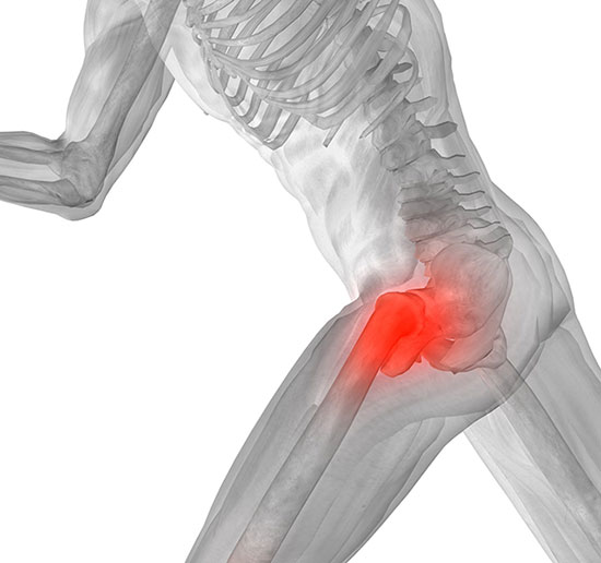 Причины и лечение боли в тазобедренном суставе при ходьбе