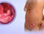 Размеры желтого тела при беременности по неделям и когда оно появляется