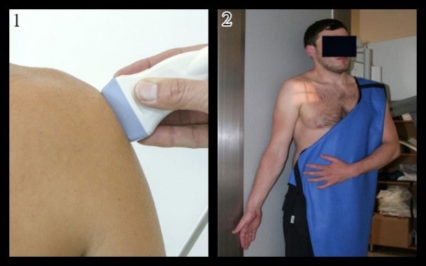 Причины растяжения связок плечевого сустава, симптомы, как лечить