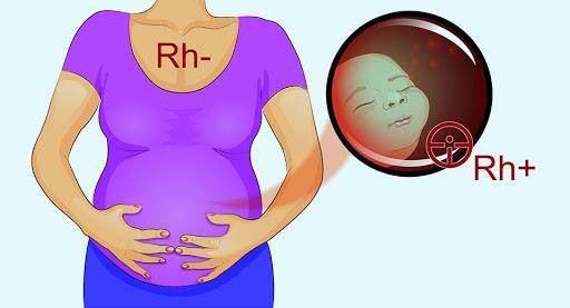 Резус-конфликт матери и ребенка при беременности и таблица по группам крови