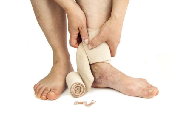 Распознаем грибок ногтей на ногах на начальной стадии