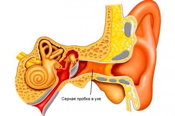 Почему при остеохондрозе закладывает и болят уши: симптомы и лечение