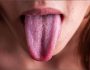 Боль в горле и запах изо рта: названы главные симптомы редчайшей формы рака
