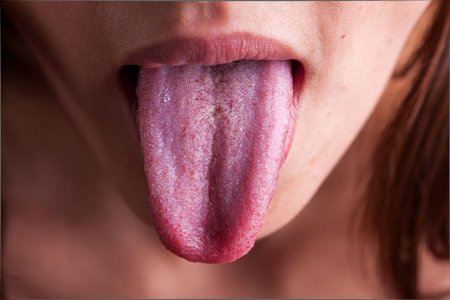 Боль в горле и запах изо рта: названы главные симптомы редчайшей формы рака