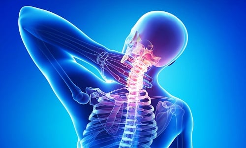 Возможные причины боли в шее и плече, отдающей в руку