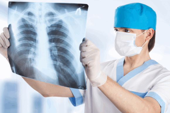 Можно ли делать рентген мамам при грудном вскармливании и грудничкам