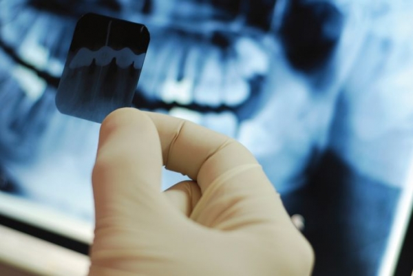 Можно ли лечить зубы при ГВ и делается ли анестезия, какие процедуры допустимы